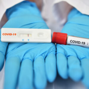 Salud Pública reporta 393 nuevos casos por coronavirus