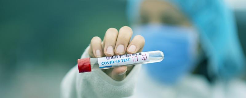 Coronavirus: Salud Pública reporta 311 nuevos casos sin muertes