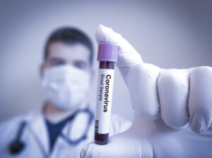 Coronavirus: Salud Pública reporta 54 nuevos casos sin defunciones